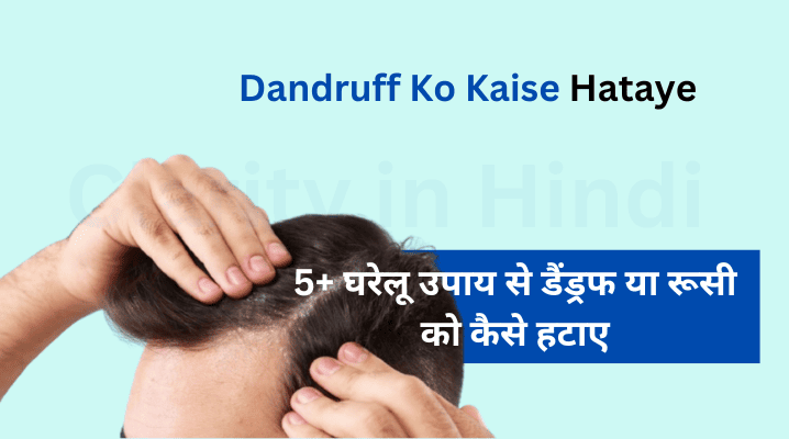 Dandruff Ko Kaise Hataye